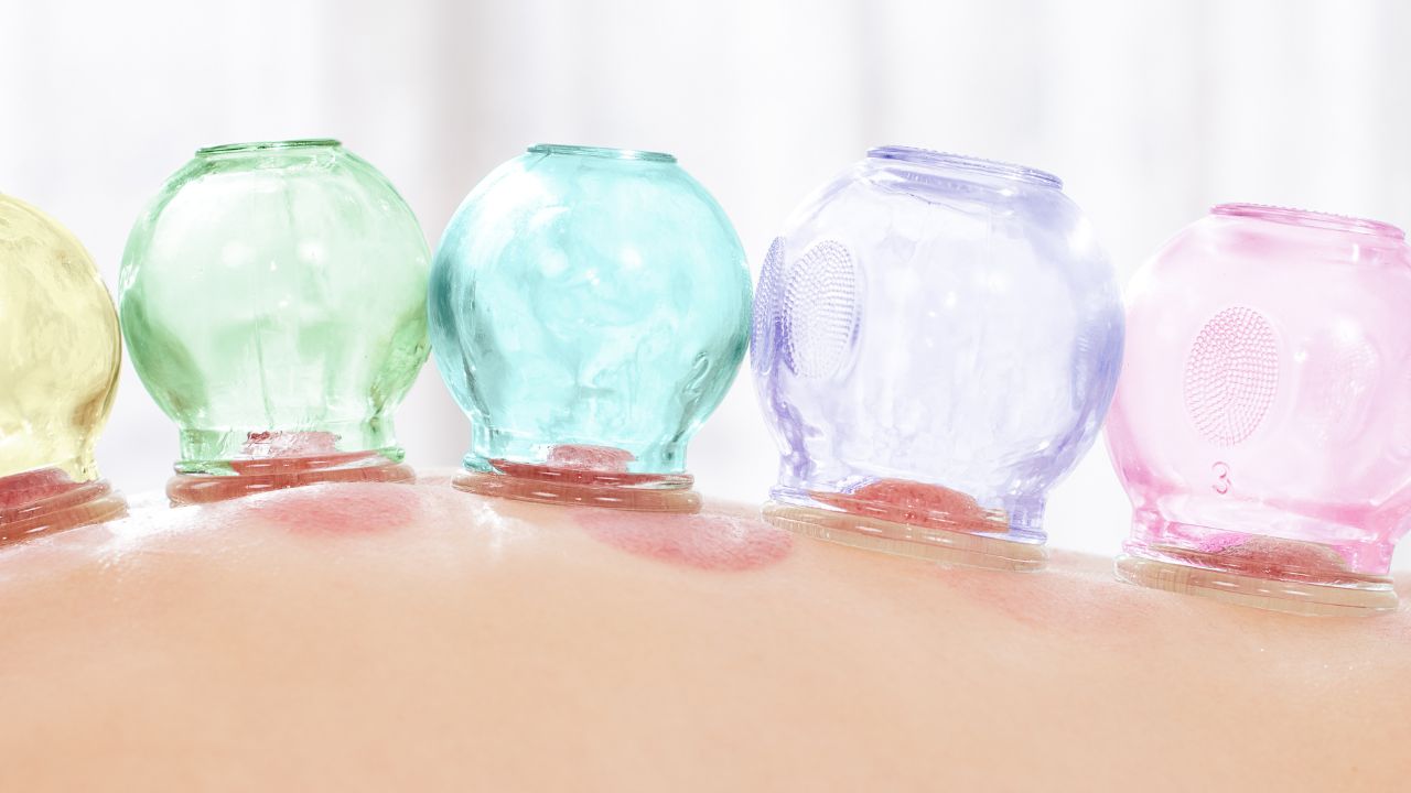A woman's stomach is filled with different colored bottles during alternative medicine fertility treatments in Fort Lauderdale, Florida. atma acupuncture
